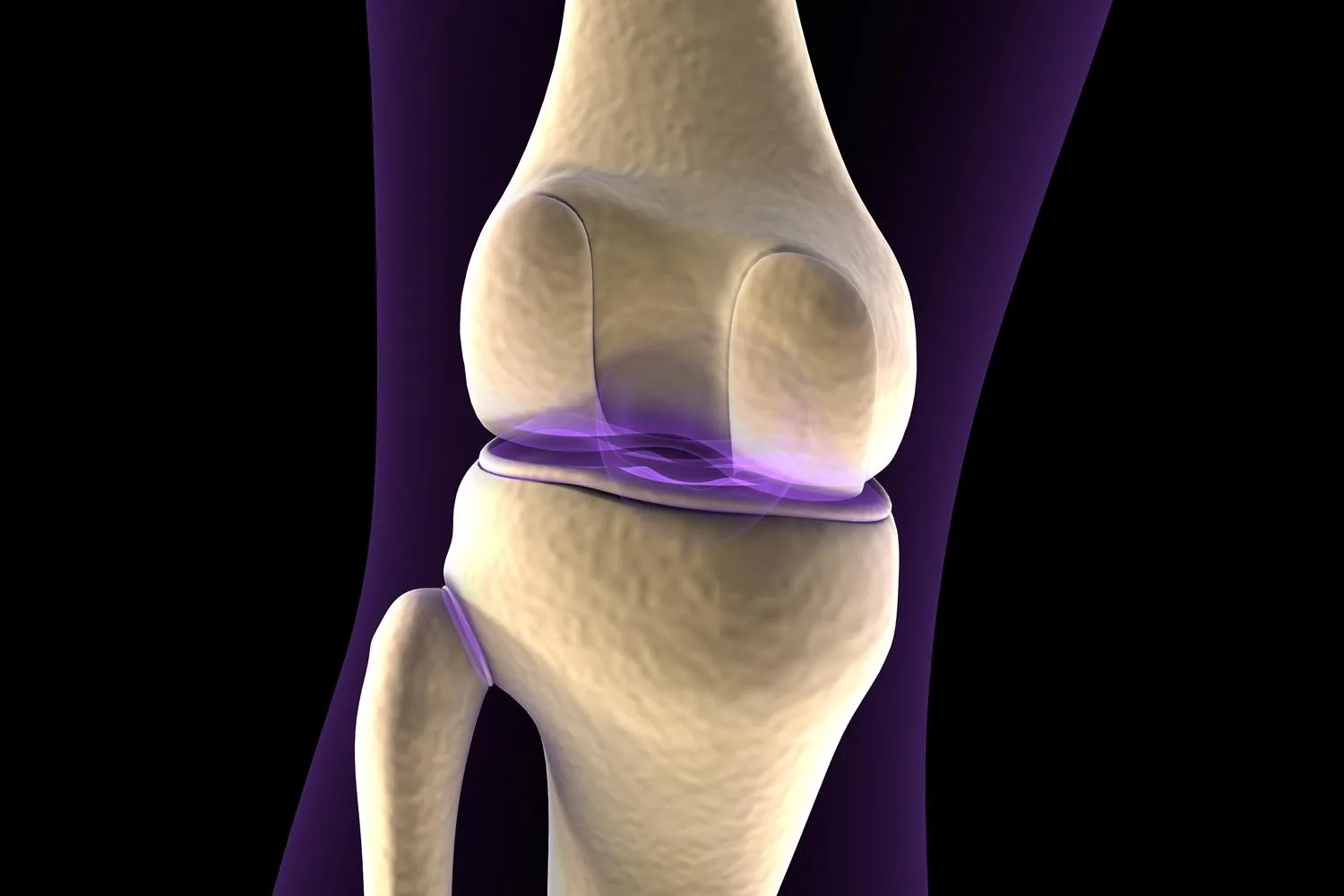 Cirugía de prótesis de rodilla